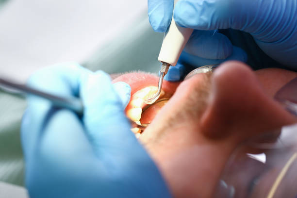 Best Emergency Root Canal Treatment in Cadiz, KY